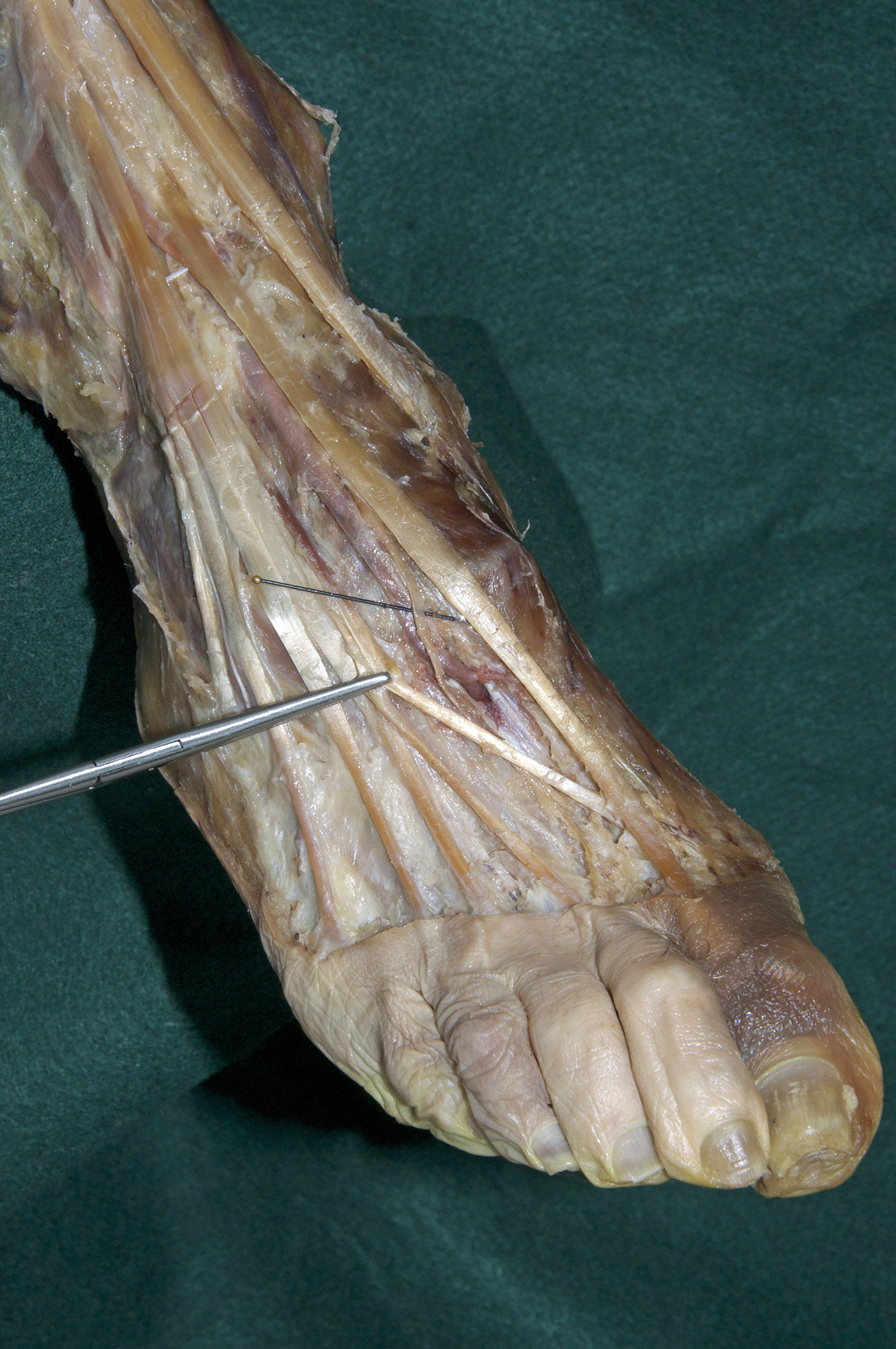 Dorsal Foot - 6