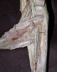 Arteries and Nerves