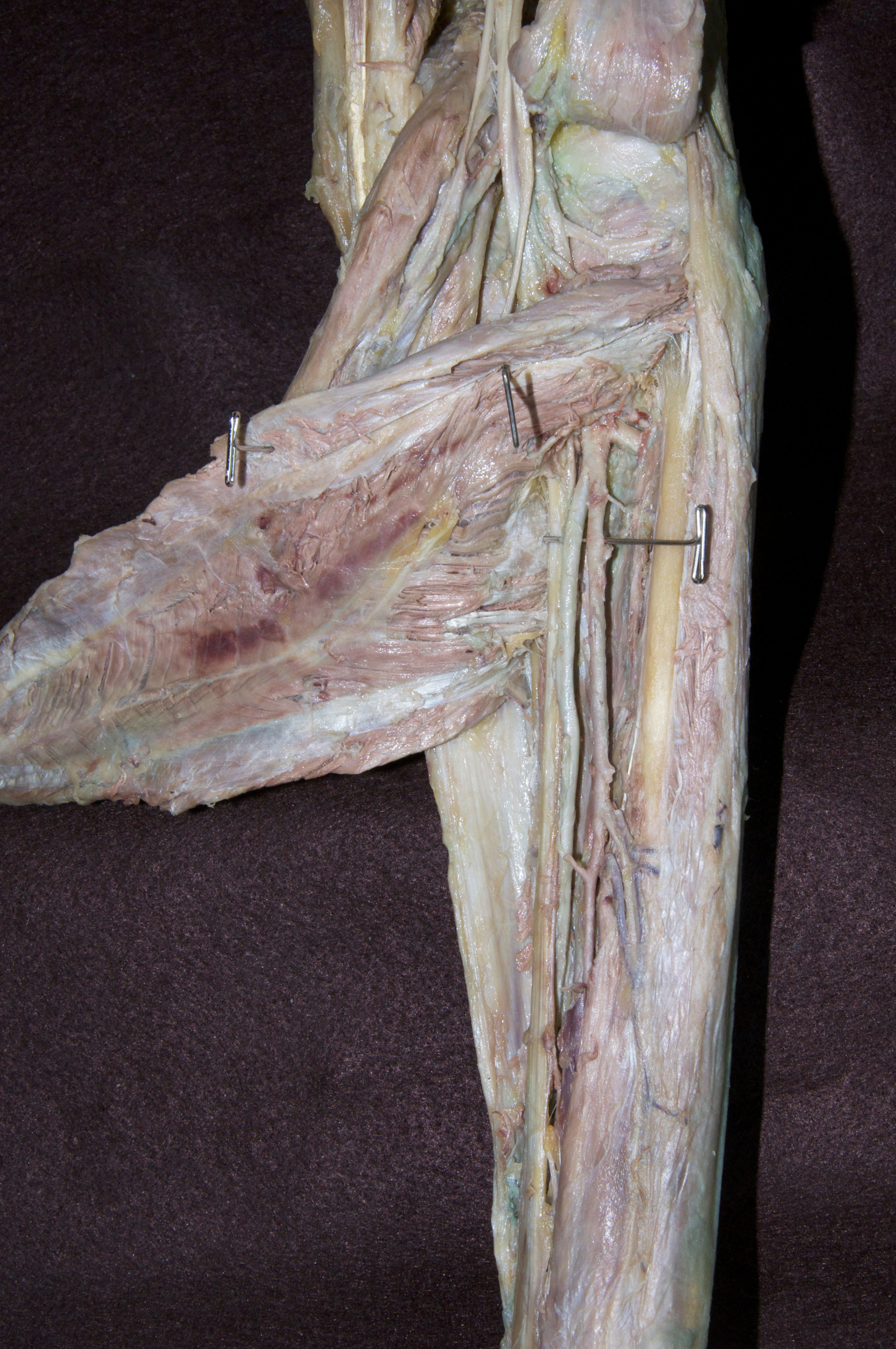 Posterior Leg - 3