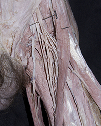 Erector Spinae Muscles