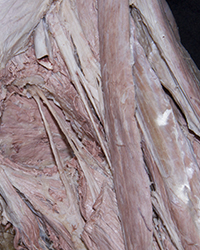 Erector Spinae Muscles