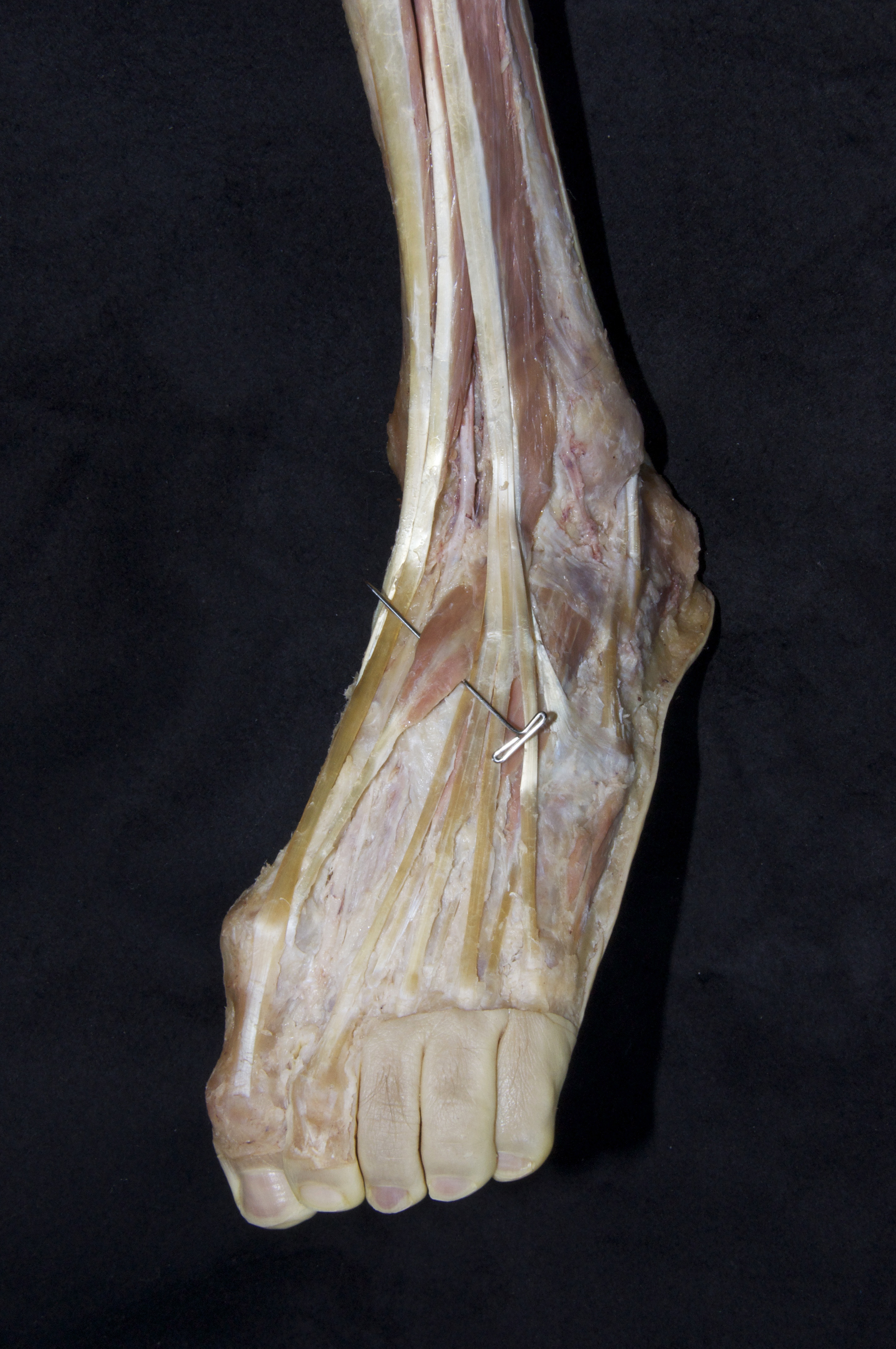 Anterior Leg - 3