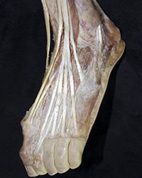 Deep Dorsal Foot