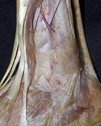 Erector Spinae Muscles