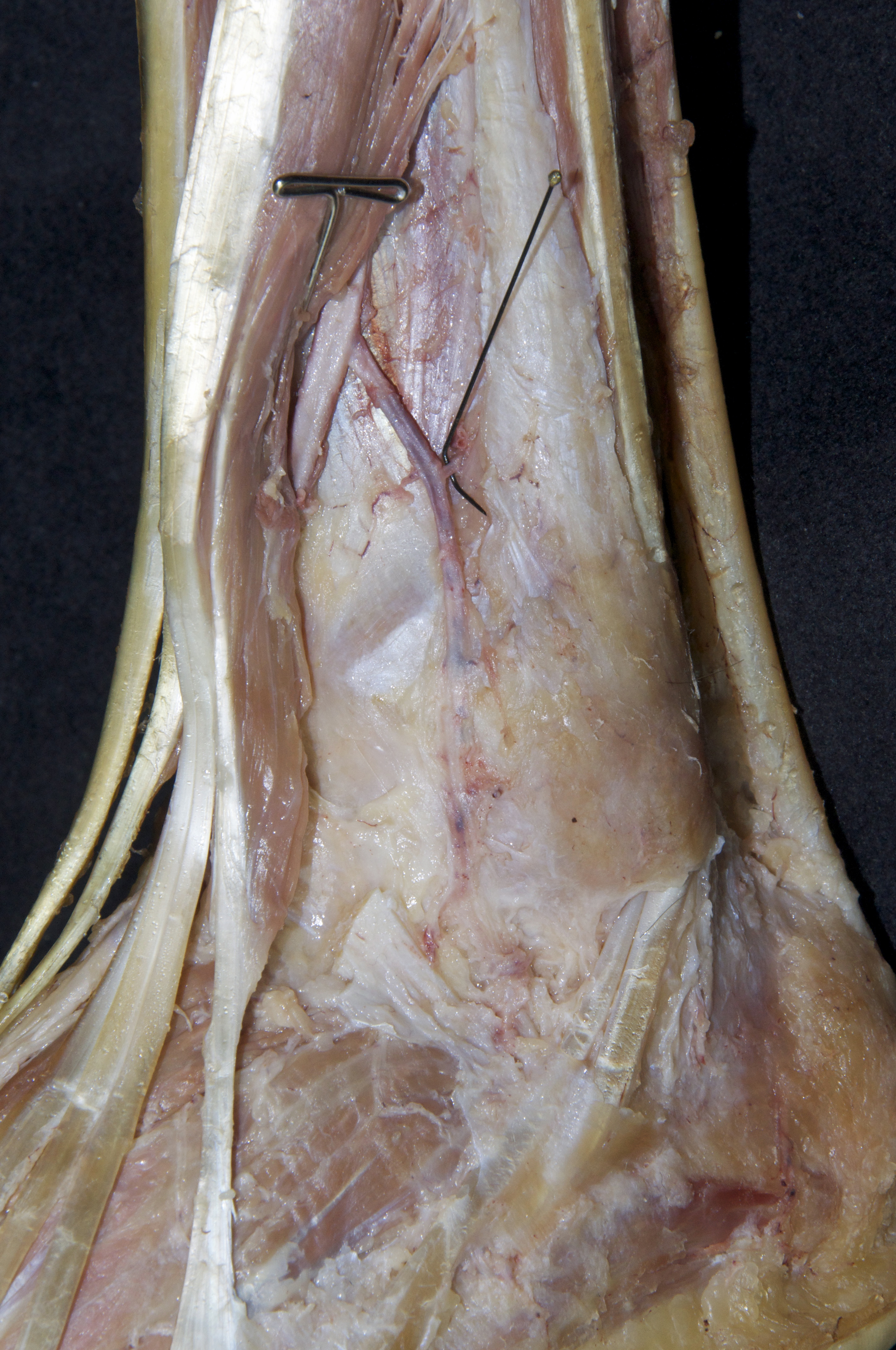 Anterior Leg - 5