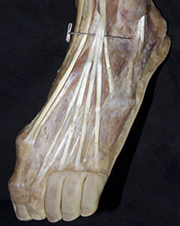 Erector Spinae Muscles