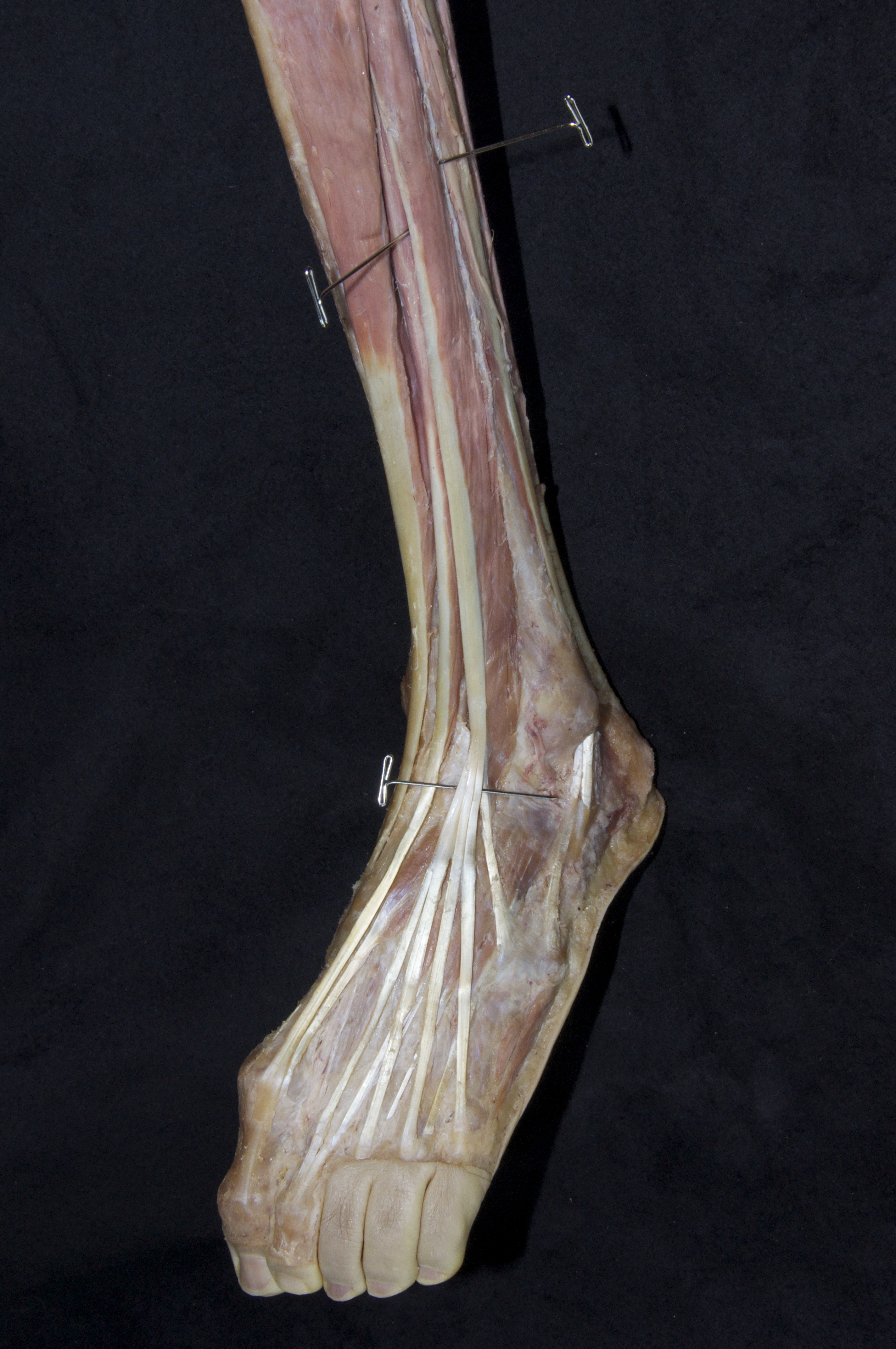 Anterior Leg - 4