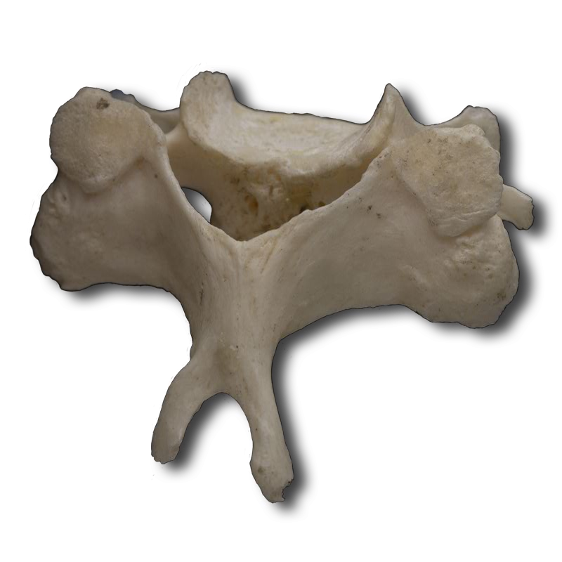 Posterior Cervical Vertebrae