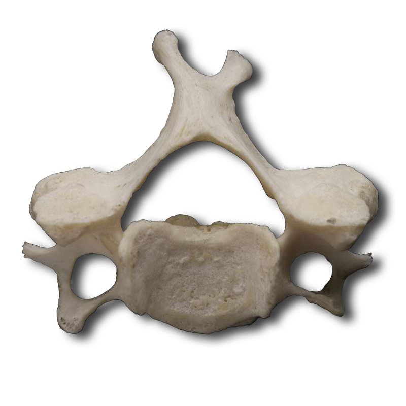 Superior Cervical Vertebrae