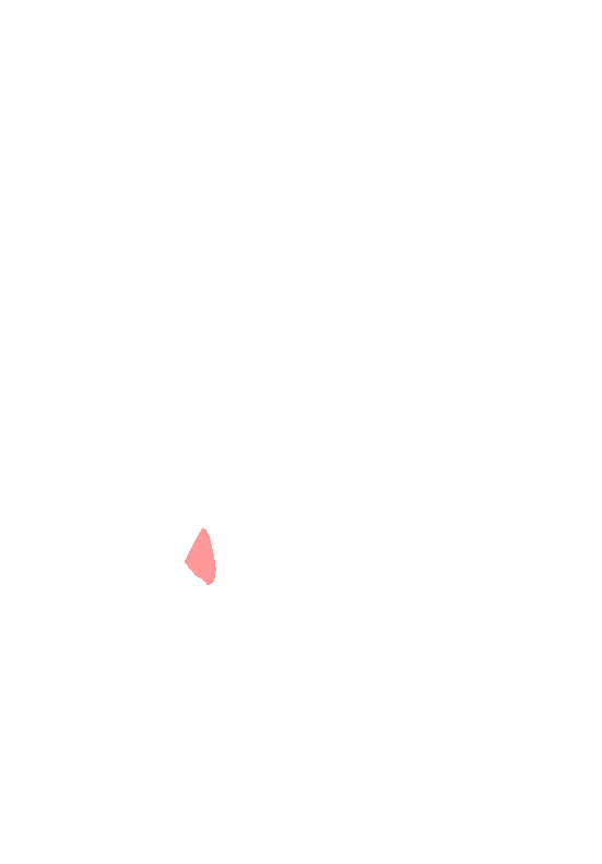 Ischial Spine