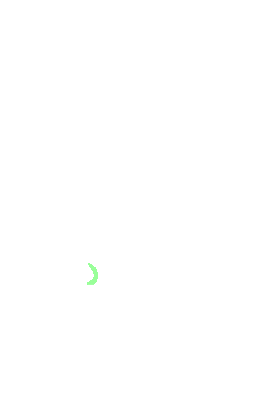 Lesser Sciatic Notch