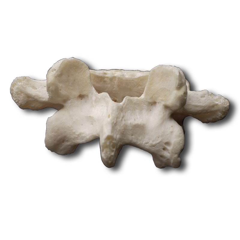 Posterior Lumbar Vertebrae