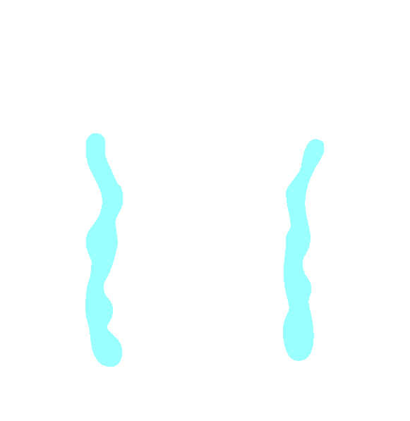 Lateral Sacral Crest