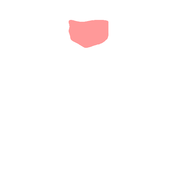 Sacral Canal
