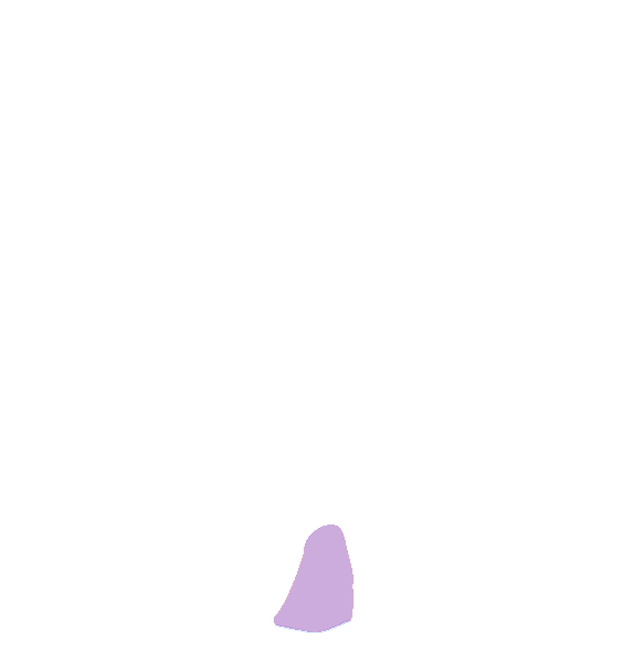 Sacral Hiatus