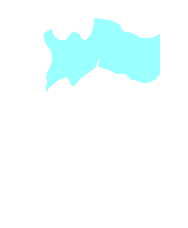 C3 Vertebra
