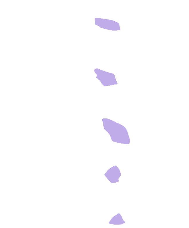 Uncinate Processes