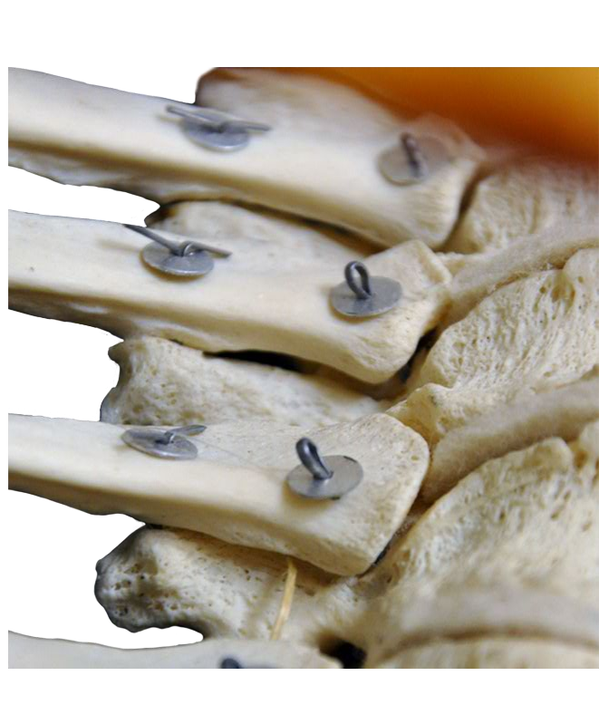 Anterior Thoracic Spine