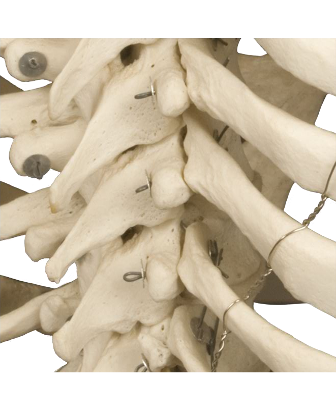Posterior Lateral Thoracic Spine