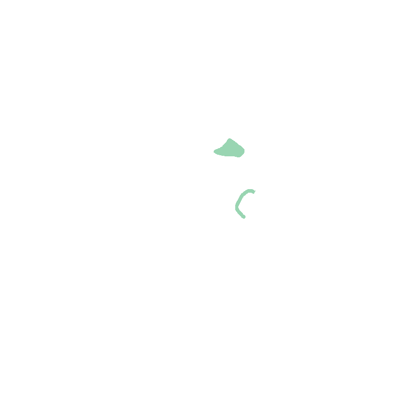 Vertebral Notch