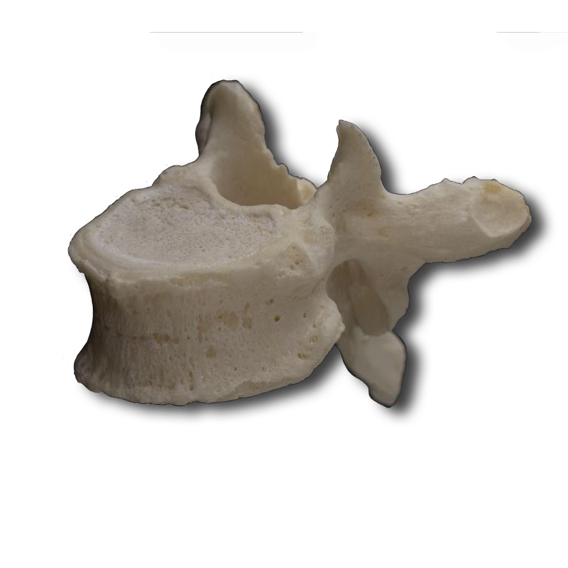 Antero-Lateral Thoracic Vertebrae