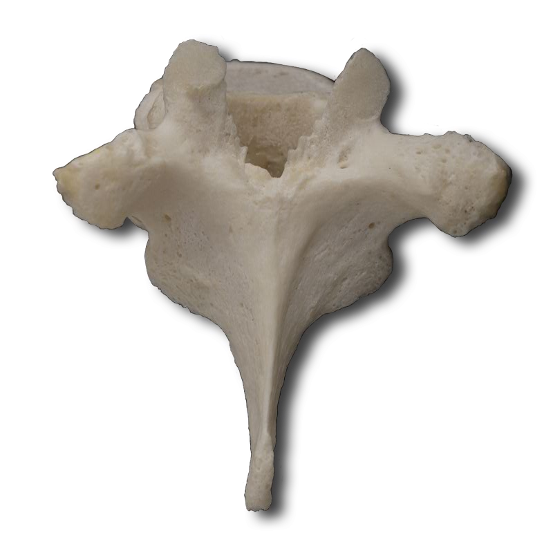 Posterior Thoracic Vertebrae