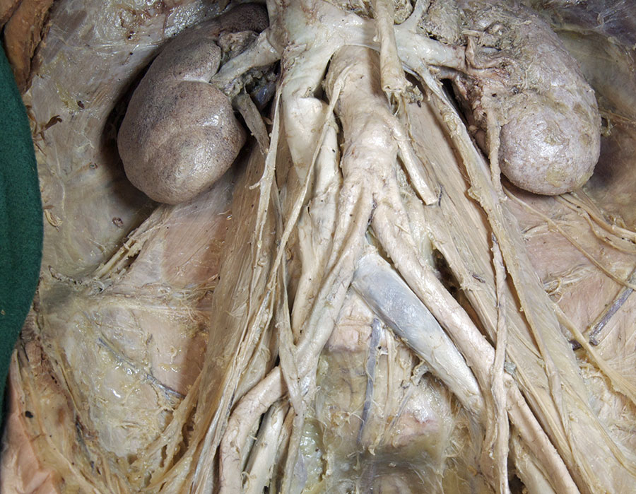 Right Testicular Artery and Vein