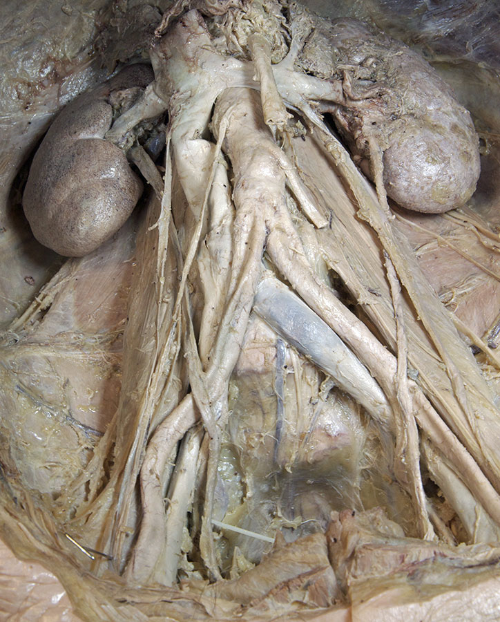 Left and Right Ureters