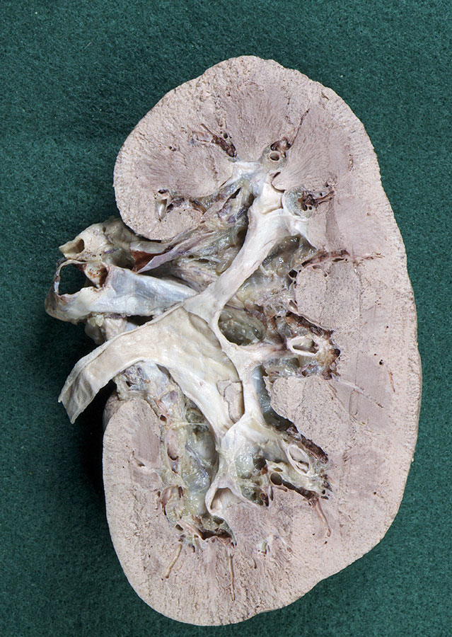 Internal Features of the Kidney (right kidney from behind)