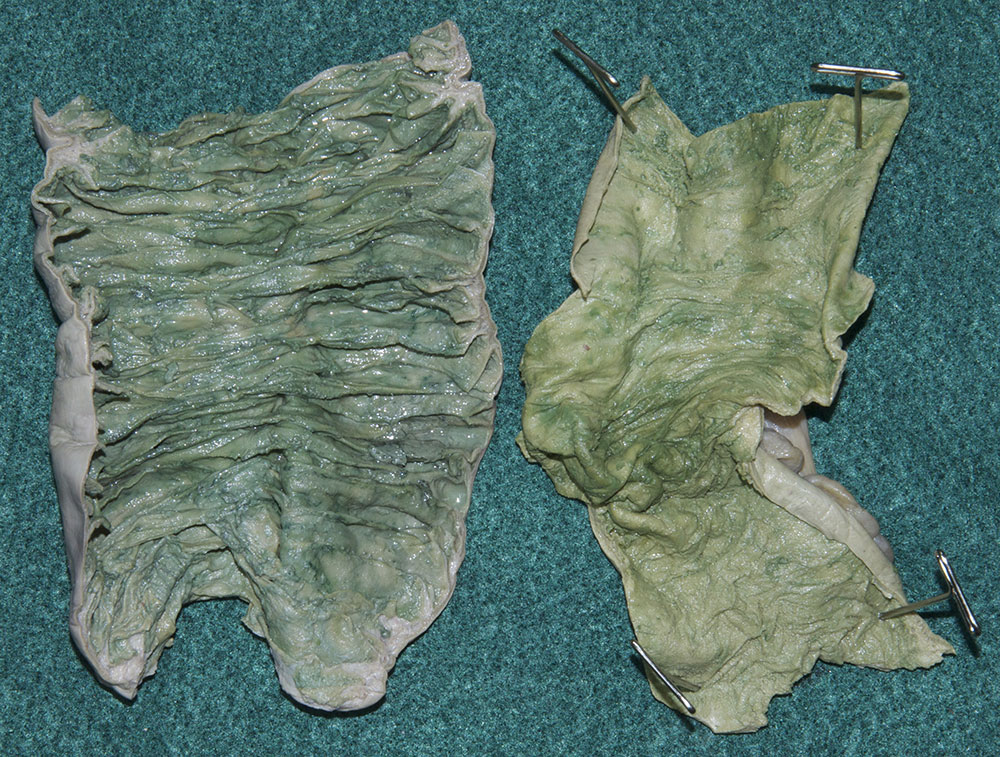 Interior of the Jejunum and Ileum