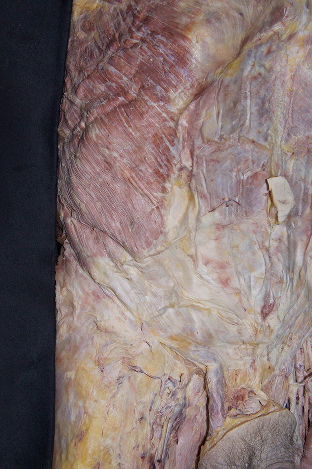 External Oblique Muscle