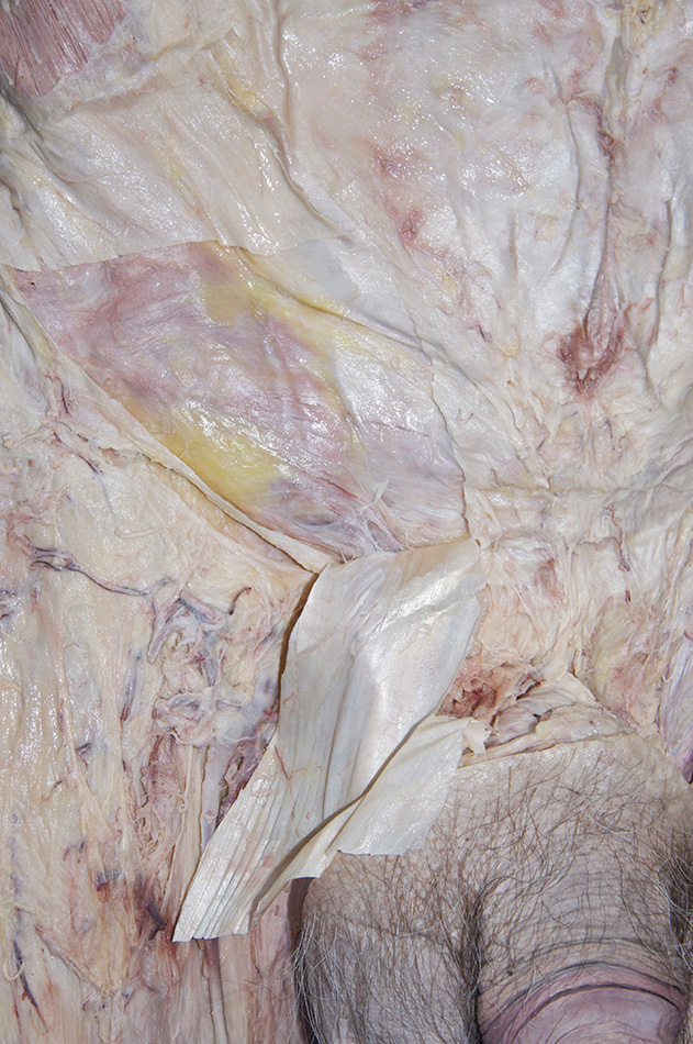Internal Oblique Muscle