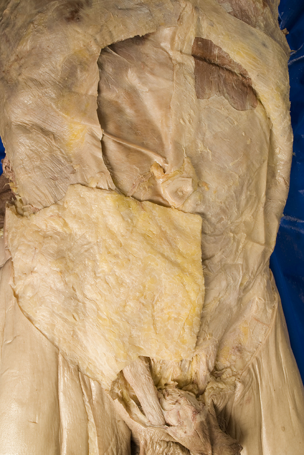 Camper's Superficial Fascia