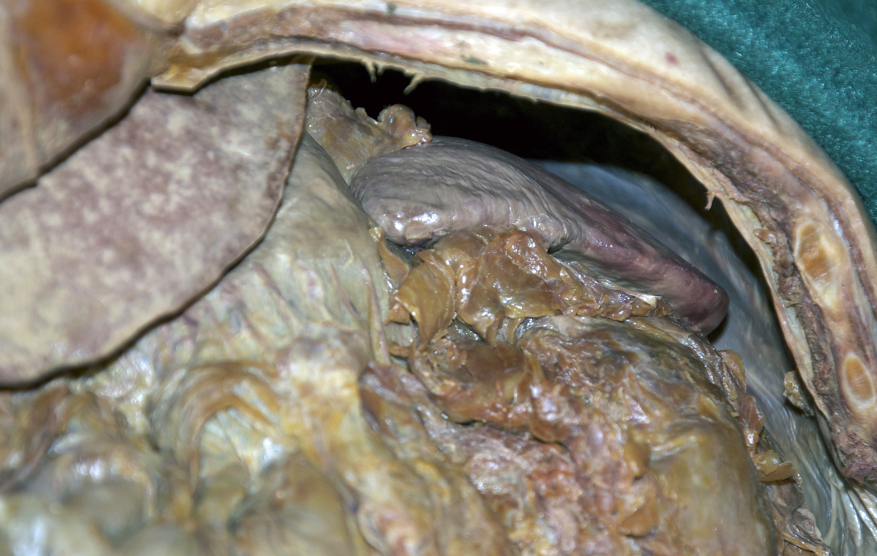 Spleen