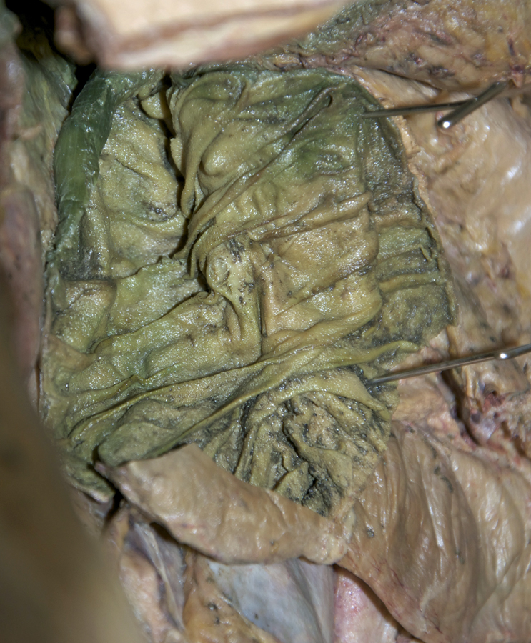 Major Duodenal Papilla