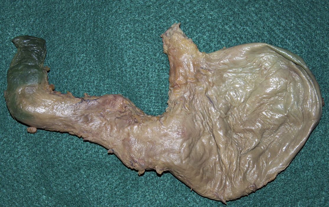 Surface Features of the Stomach