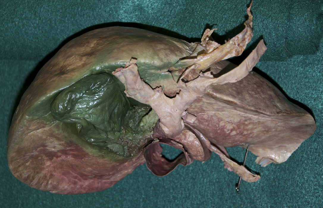 Isolated Liver