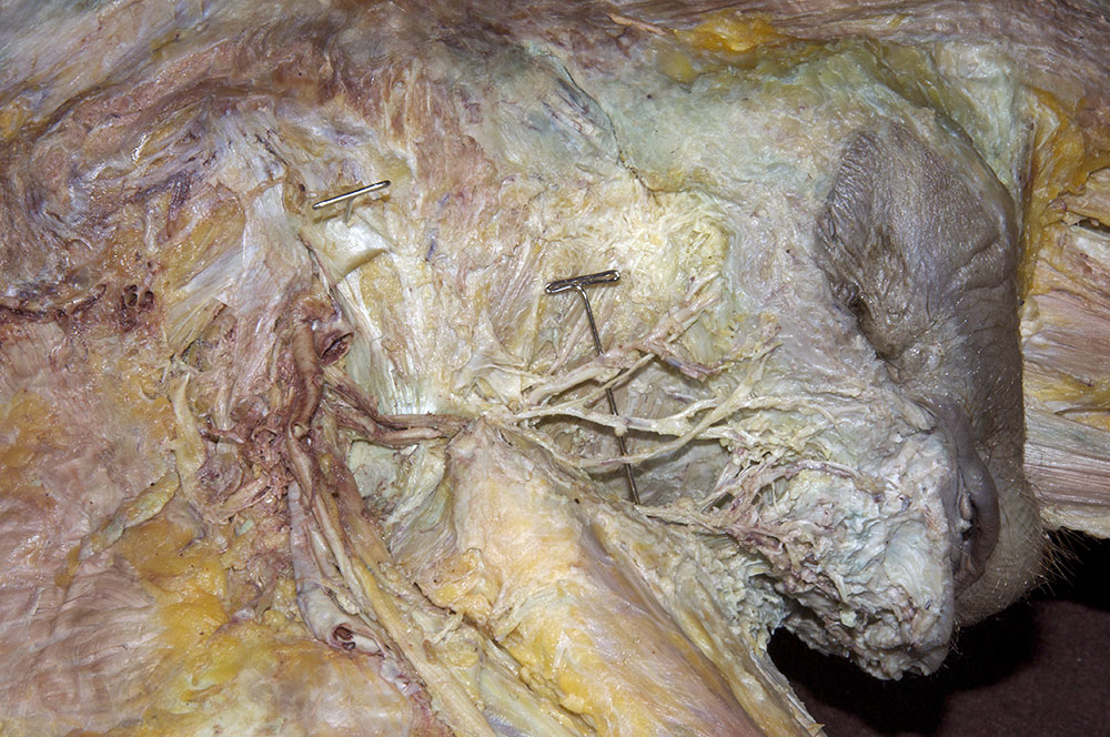 Inferior Rectal Nerve and Vessels