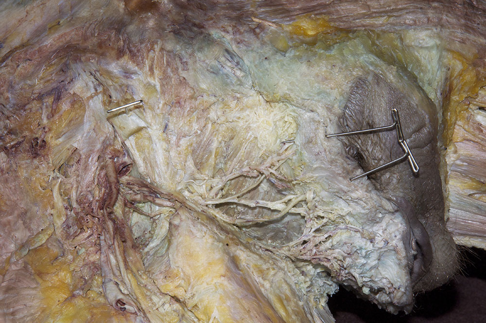 External Anal Sphincter and Pelvic Diaphragm