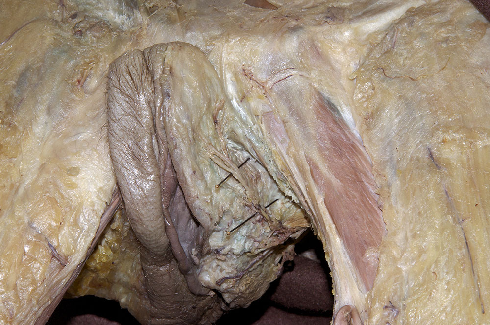 Posterior Labial Nerves and Vessels