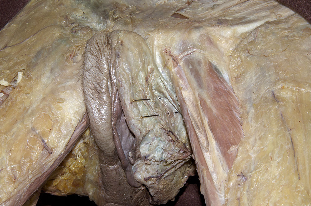 Bulbospongiosus Muscle