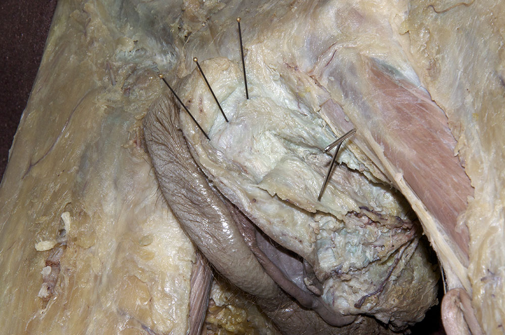 Clitoris