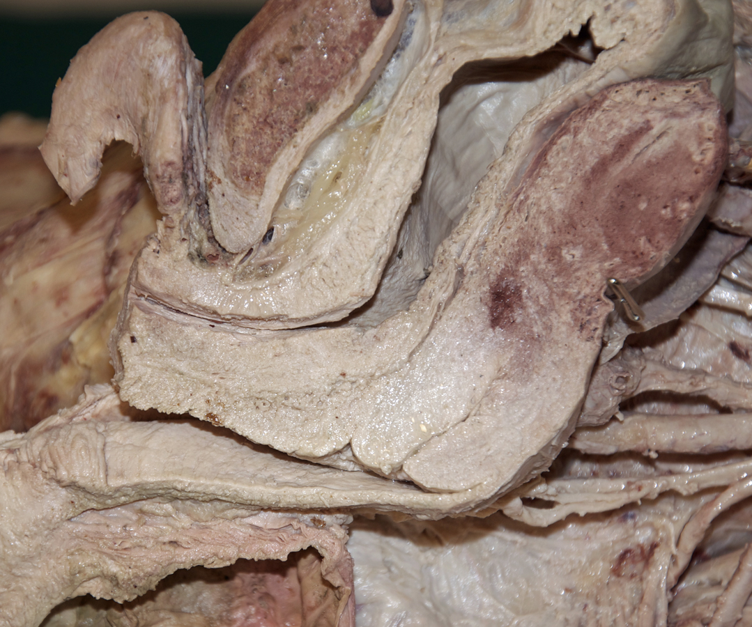Urethra (inferior-left view; right hemisected pelvis)