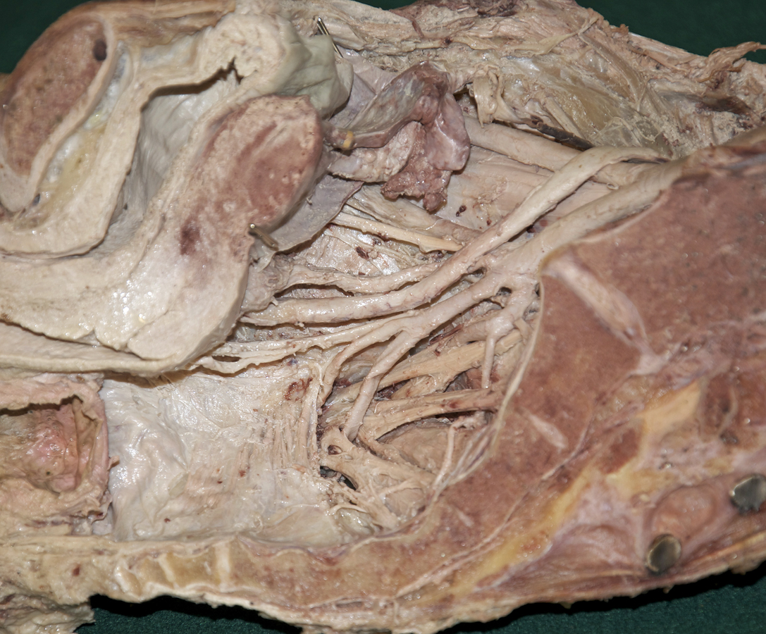 Anterior Trunk Branches (inferior to the left; right hemisected pelvis)