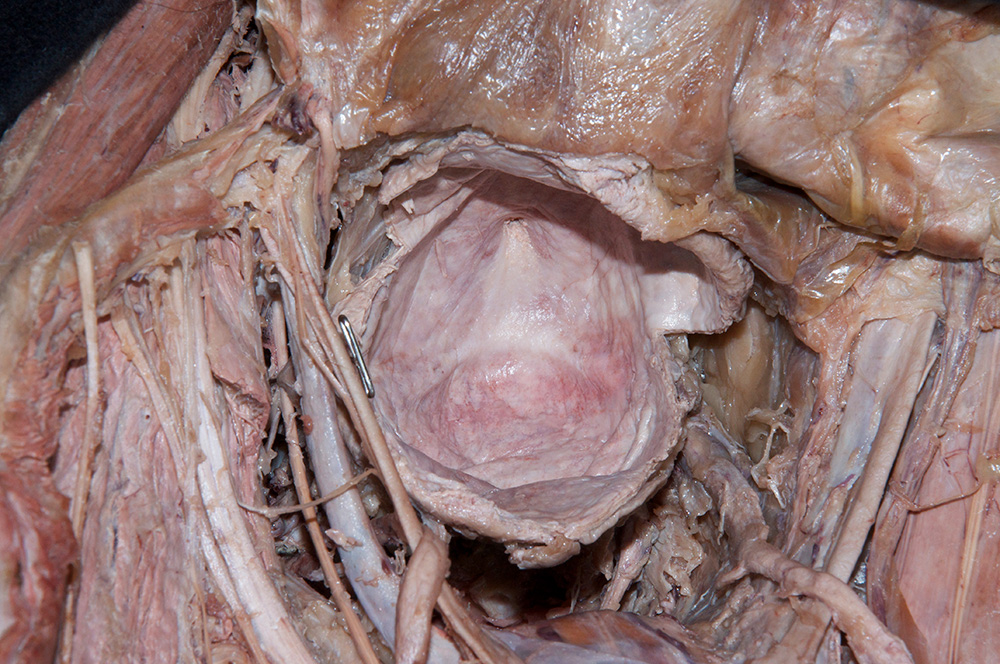 Urinary Bladder