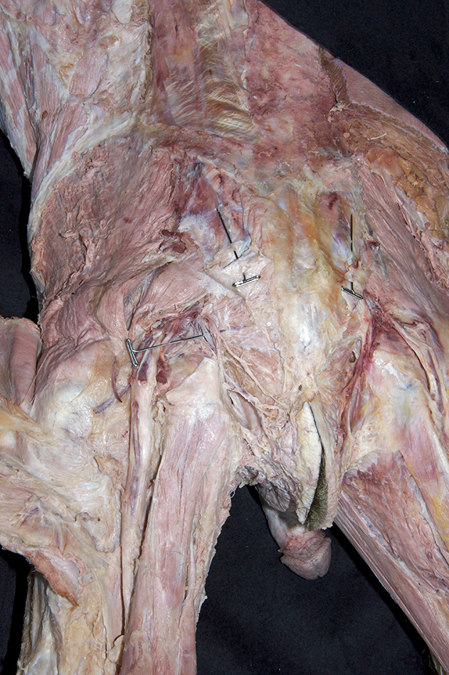 Ischiorectal (ischioanal) Fossa