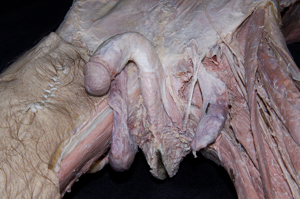 Root of Penis
