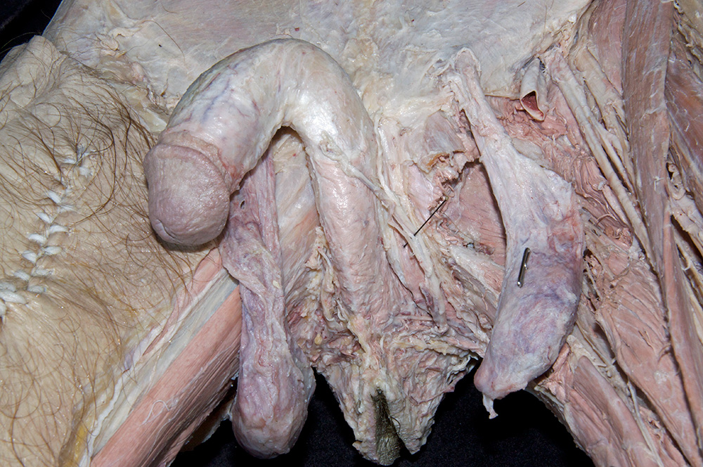 Posterior Scrotal Nerves and Vessels
