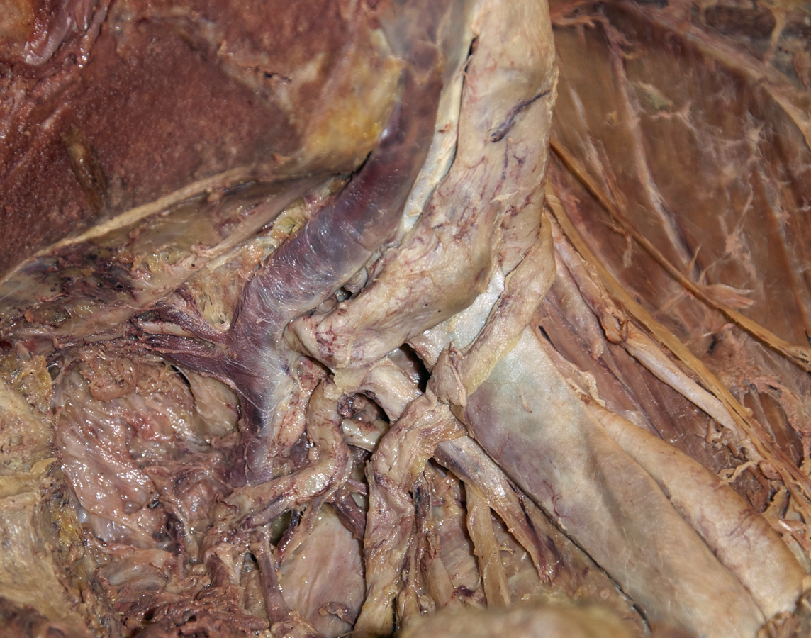 Internal and External Iliac Veins (hemisected pelvis; anterior to the right)