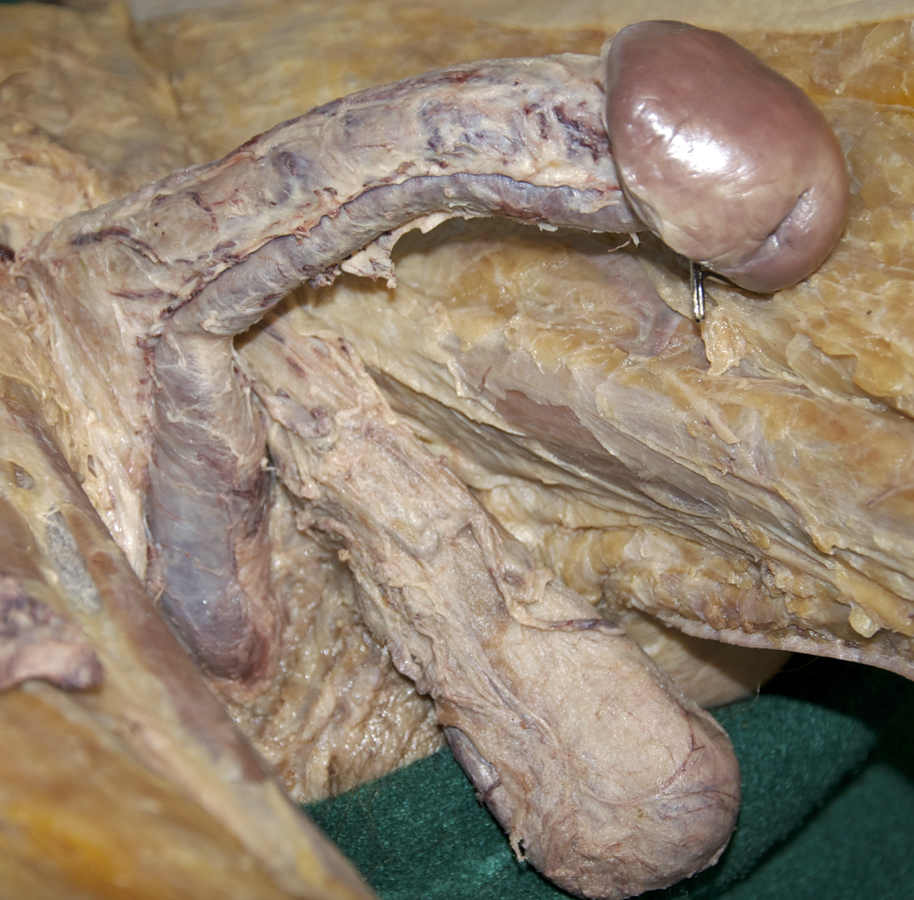 Erectile Bodies of Penis